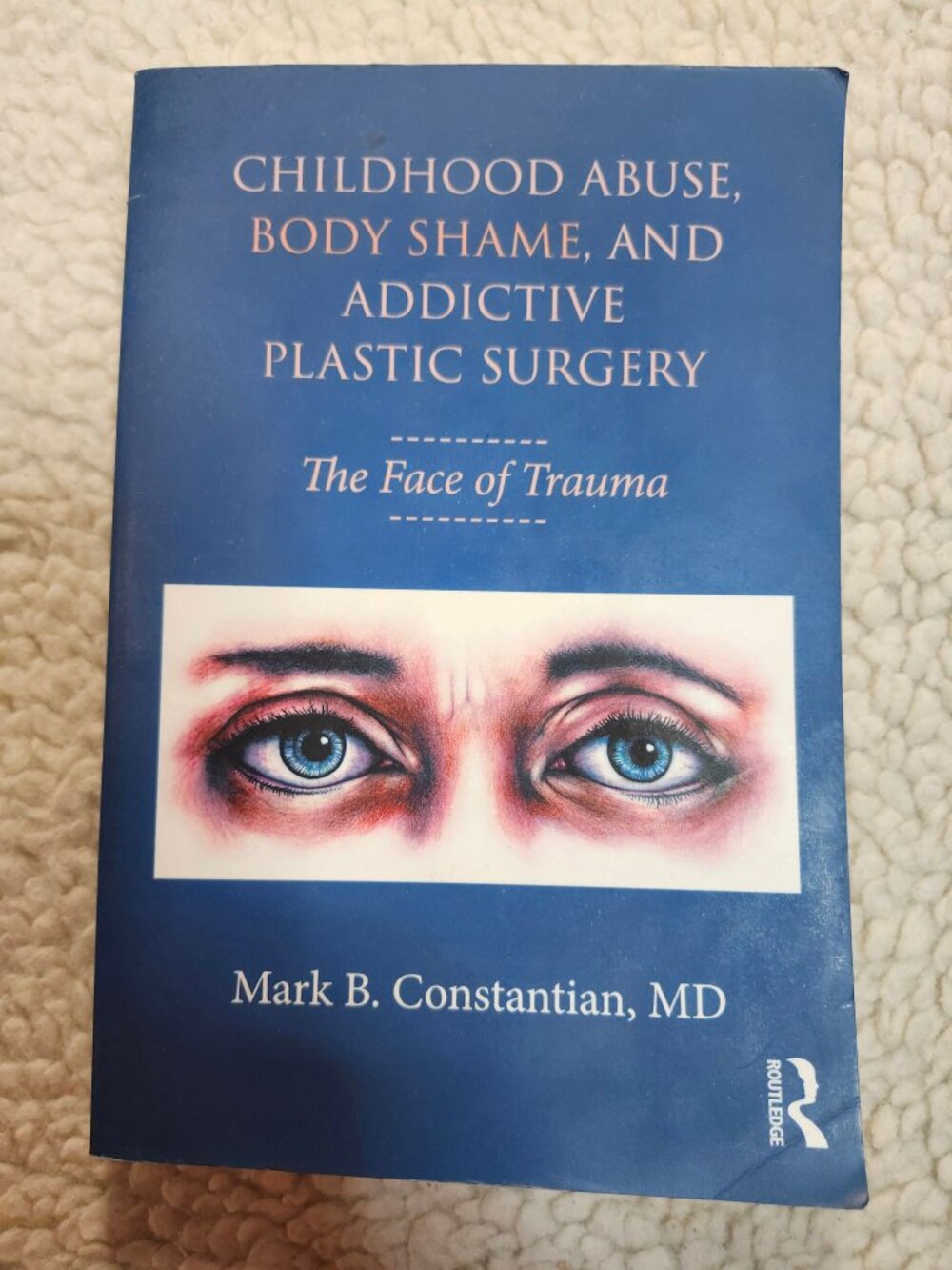 Childhood Abuse Body Shame Addictive Plastic Surgery Mark Constantian Paperback